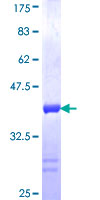 ab161814 on a 12.5% SDS-PAGE stained with Coomassie Blue.