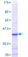 ab153553 on a 12.5% SDS-PAGE stained with Coomassie Blue.