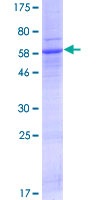 ab165711 on a 12.5% SDS-PAGE stained with Coomassie Blue.