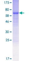 ab159967 on a 12.5% SDS-PAGE stained with Coomassie Blue.