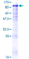 ab160753 on a 12.5% SDS-PAGE stained with Coomassie Blue.