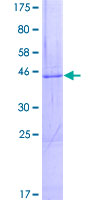 ab160073 on a 12.5% SDS-PAGE stained with Coomassie Blue.