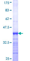 ab160074 on a 12.5% SDS-PAGE stained with Coomassie Blue.