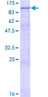 ab158261 on a 12.5% SDS-PAGE stained with Coomassie Blue.
