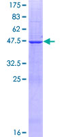 ab165872 on a 12.5% SDS-PAGE stained with Coomassie Blue.