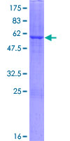 ab165082 on a 12.5% SDS-PAGE stained with Coomassie Blue.