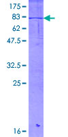 ab160873 on a 12.5% SDS-PAGE stained with Coomassie Blue.