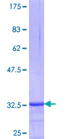 ab160874 on a 12.5% SDS-PAGE stained with Coomassie Blue.