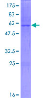 ab160402 on a 12.5% SDS-PAGE stained with Coomassie Blue.