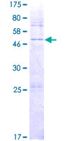ab166236 on a 12.5% SDS-PAGE stained with Coomassie Blue.