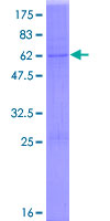 ab161853 on a 12.5% SDS-PAGE stained with Coomassie Blue.