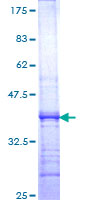 ab160034 on a 12.5% SDS-PAGE stained with Coomassie Blue.