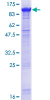 ab163208 on a 12.5% SDS-PAGE stained with Coomassie Blue.