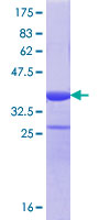 ab160651 on a 12.5% SDS-PAGE stained with Coomassie Blue.