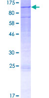 ab164067 on a 12.5% SDS-PAGE stained with Coomassie Blue.
