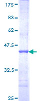 ab158283 on a 12.5% SDS-PAGE stained with Coomassie Blue.