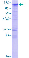 ab153532 on a 12.5% SDS-PAGE stained with Coomassie Blue.