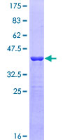 ab153533 on a 12.5% SDS-PAGE stained with Coomassie Blue.