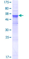 ab165392 on a 12.5% SDS-PAGE stained with Coomassie Blue.