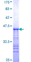 ab161563 on a 12.5% SDS-PAGE stained with Coomassie Blue.