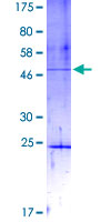 ab161564 on a 12.5% SDS-PAGE stained with Coomassie Blue.