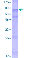 ab164696 on a 12.5% SDS-PAGE stained with Coomassie Blue.