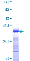 ab161467 on a 12.5% SDS-PAGE stained with Coomassie Blue.