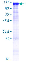 ab165081 on a 12.5% SDS-PAGE stained with Coomassie Blue.