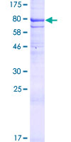 ab164722 on a 12.5% SDS-PAGE stained with Coomassie Blue.