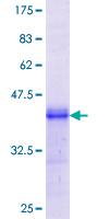 ab164723 on a 12.5% SDS-PAGE stained with Coomassie Blue.