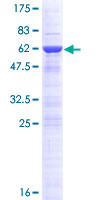 ab161436 on a 12.5% SDS-PAGE stained with Coomassie Blue.