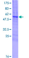 ab162084 on a 12.5% SDS-PAGE stained with Coomassie Blue.