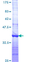 ab160394 on a 12.5% SDS-PAGE stained with Coomassie Blue.