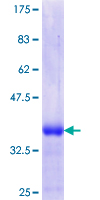 ab160393 on a 12.5% SDS-PAGE stained with Coomassie Blue.