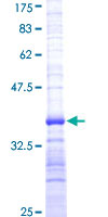 ab162166 on a 12.5% SDS-PAGE stained with Coomassie Blue.