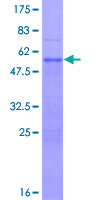 ab158287 on a 12.5% SDS-PAGE stained with Coomassie Blue.