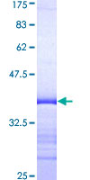 ab158288 on a 12.5% SDS-PAGE stained with Coomassie Blue.