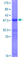 ab158289 on a 12.5% SDS-PAGE stained with Coomassie Blue.