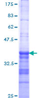 ab158290 on a 12.5% SDS-PAGE stained with Coomassie Blue.
