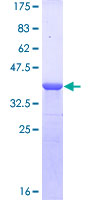 ab158291 on a 12.5% SDS-PAGE stained with Coomassie Blue.