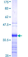 ab161096 on a 12.5% SDS-PAGE stained with Coomassie Blue.