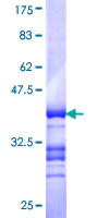 ab163692 on a 12.5% SDS-PAGE stained with Coomassie Blue.
