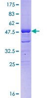 ab163760 on a 12.5% SDS-PAGE stained with Coomassie Blue.