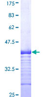 ab159014 on a 12.5% SDS-PAGE stained with Coomassie Blue.