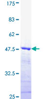ab160747 on a 12.5% SDS-PAGE stained with Coomassie Blue.