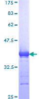 ab159153 on a 12.5% SDS-PAGE stained with Coomassie Blue.