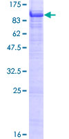 ab161348 on a 12.5% SDS-PAGE stained with Coomassie Blue.
