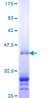 ab161349 on a 12.5% SDS-PAGE stained with Coomassie Blue.