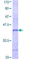 ab161121 on a 12.5% SDS-PAGE stained with Coomassie Blue.