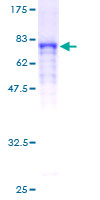 ab163097 on a 12.5% SDS-PAGE stained with Coomassie Blue.